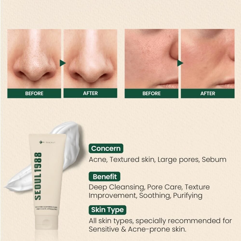 K Secret Seoul 1988 Cleansing Foam – Pine Cica