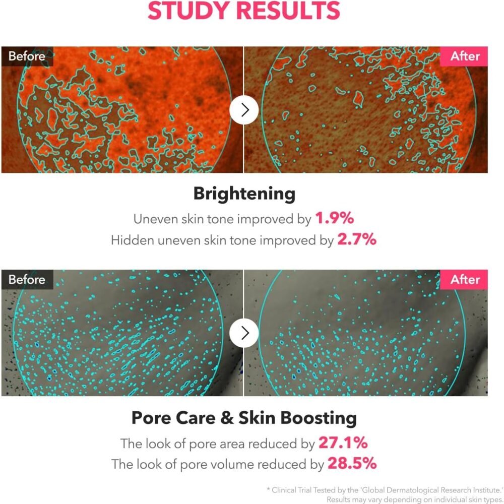 Aprilskin TXA Niacinamide Toning Shot 99 Serum