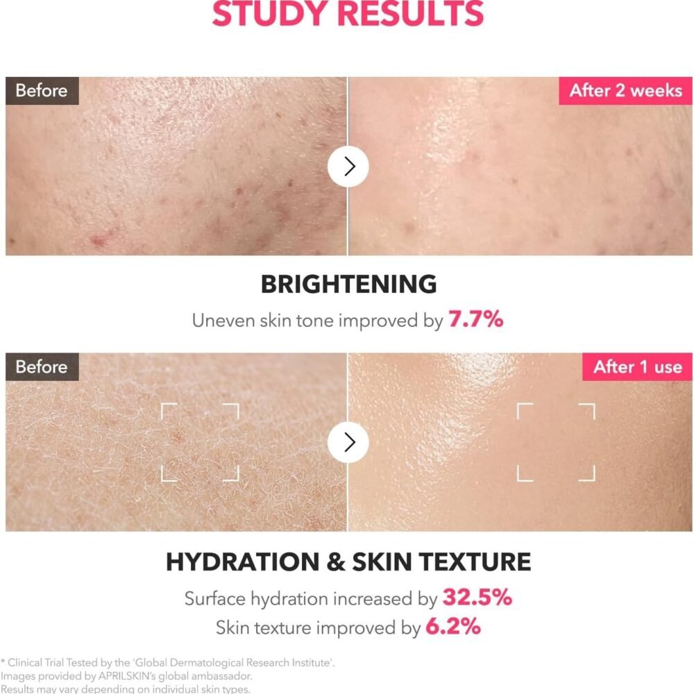 Aprilskin TXA Niacinamide 99 Milky Toner-150 ML