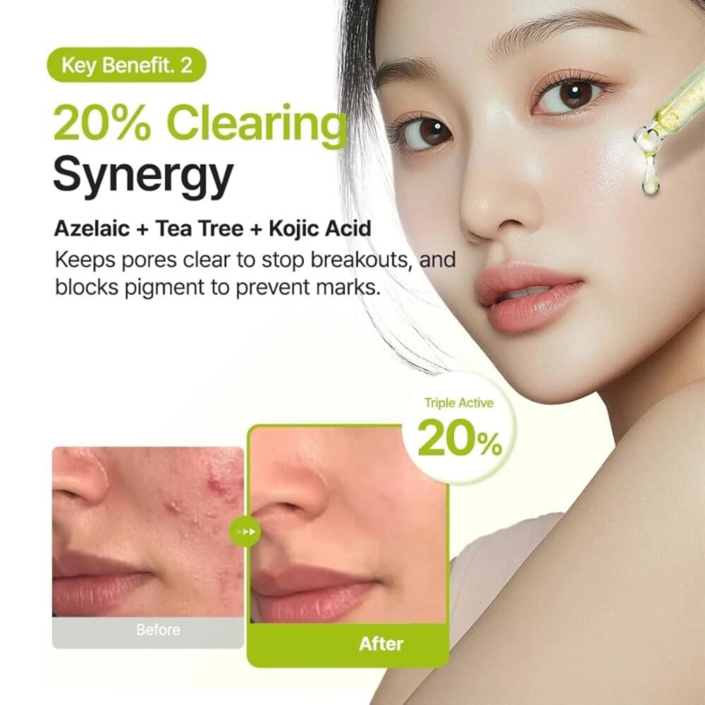 Purito Seoul Azelaic Acid 10% + Kojic + Azulene Serum – 30 ml