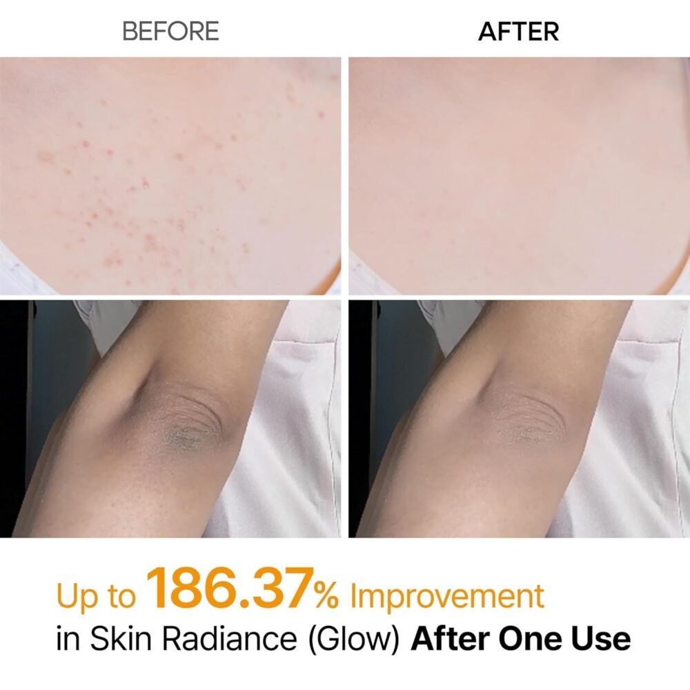 Dr Melaxin Peel Shot Exfoliating Kojic Acid Turmeric Spray 200ml