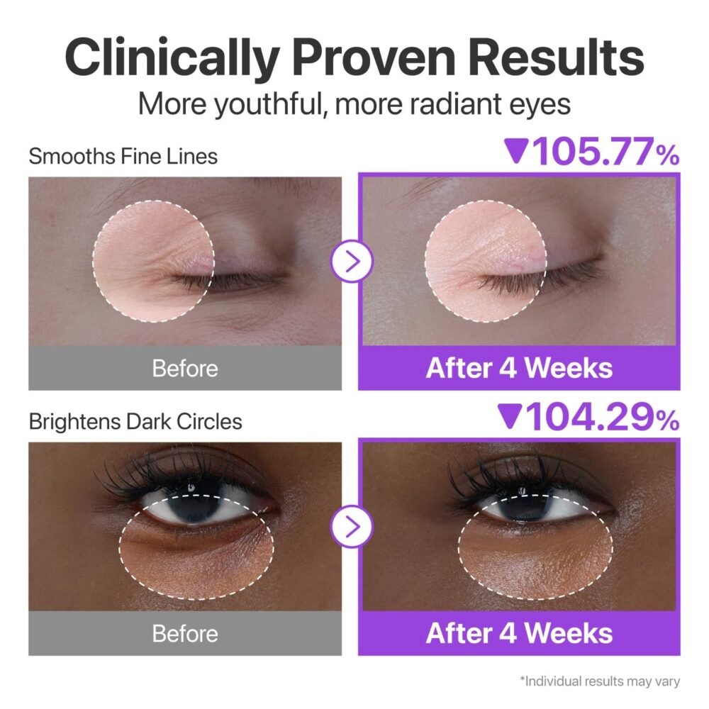 Numbuzin No. 9 NAD+ retinol volumetox eye cream