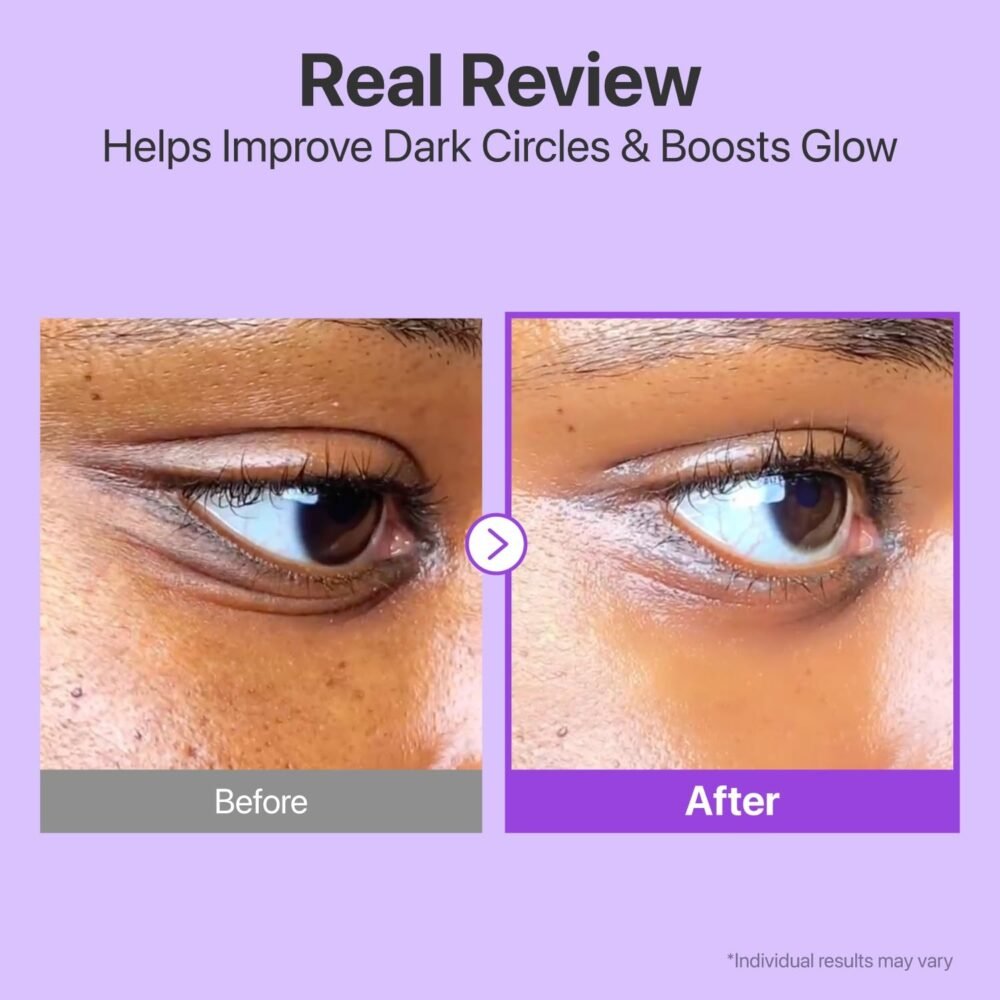 Numbuzin No. 9 NAD+ retinol volumetox eye cream