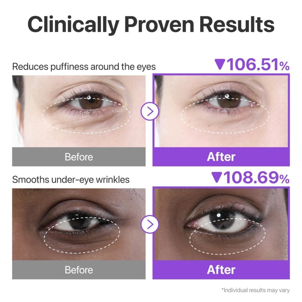 Numbuzin No.9 NMN Collagen Under Eye Patches (5 EA / 8 g)