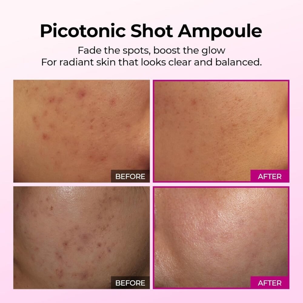 Dr. Melaxin Cemenrete Picotonic Shot Pigmentation Serum (30ml)