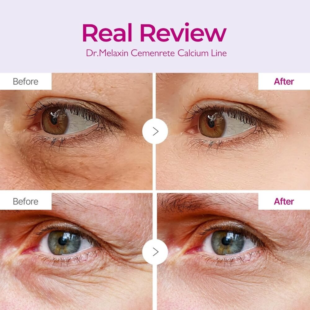 Dr. Melaxin Cemenrete Calcium Volume Eye Patch (60 patches)