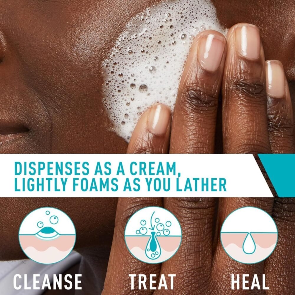 Cerave Acne Foaming Cream Wash 10% 150Ml